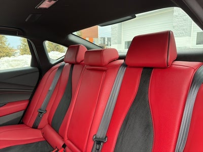 2025 Acura TLX A-Spec Package SH-AWD